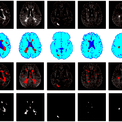 Brain tissue segmentation examples.