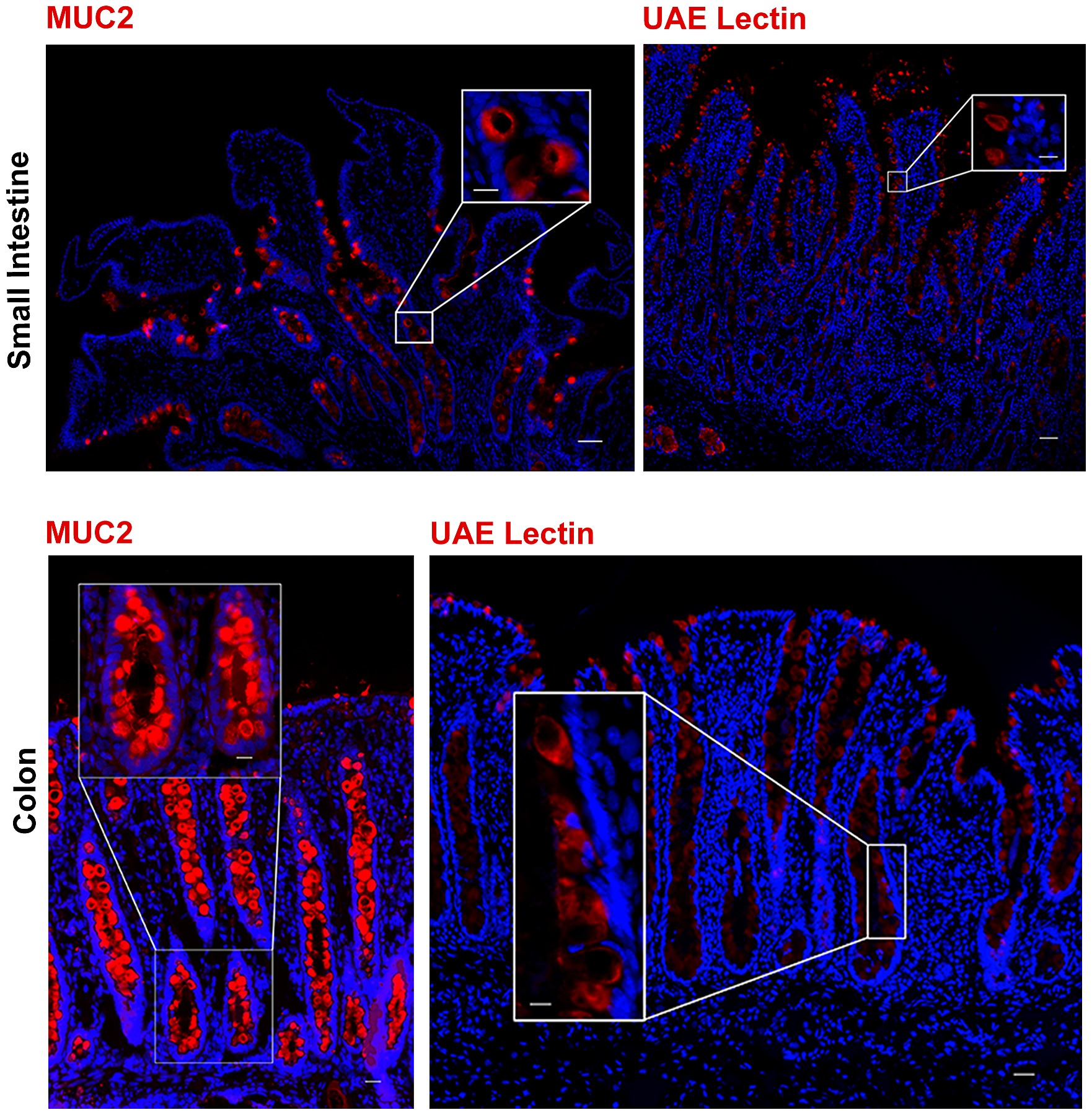 Item - Markers to identify goblet cells. - Public Library of