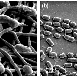SEM micrographs of polymicrobial biofilms involving P. gingivalis ...