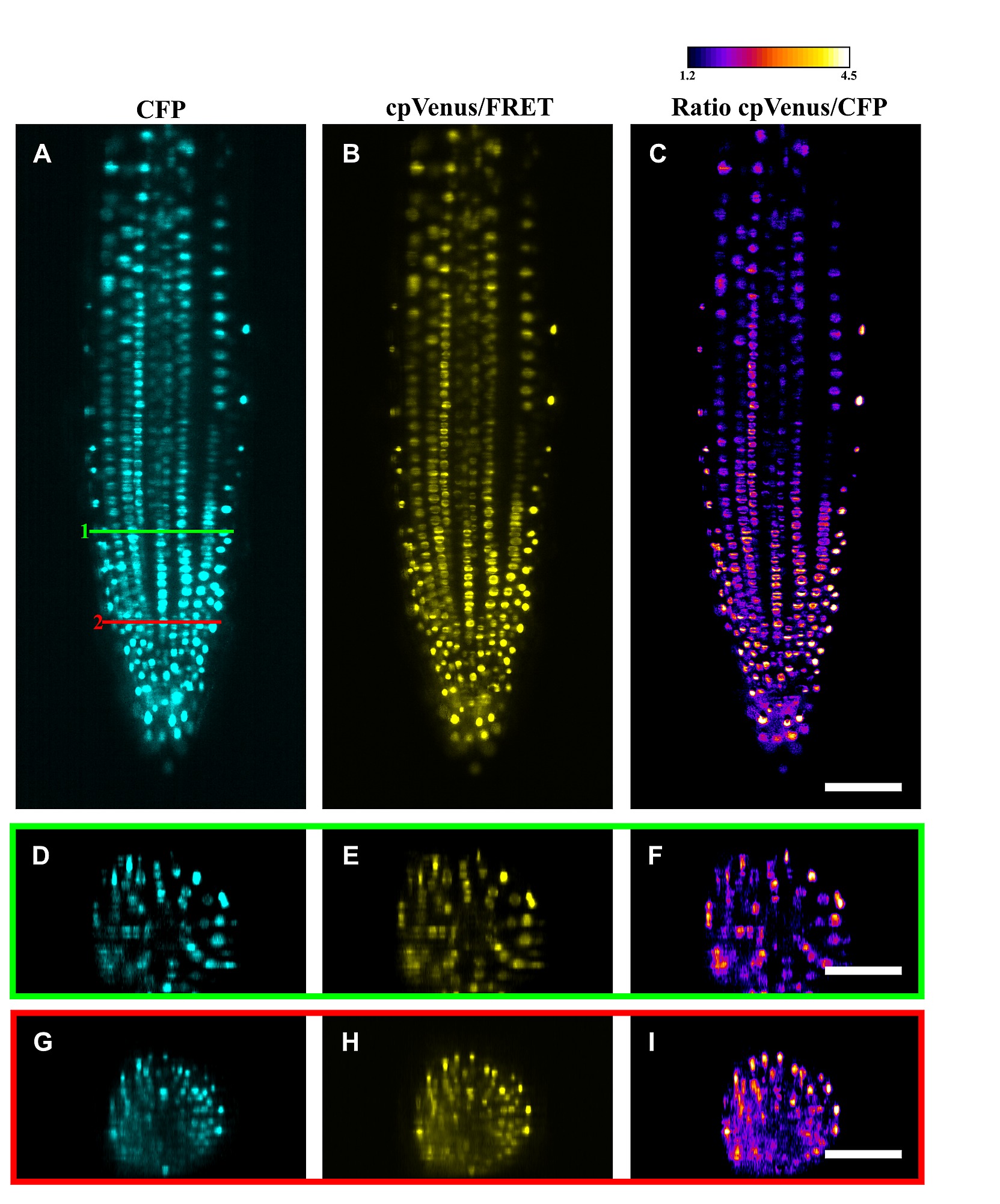 Light Sheet Microscopy Olympus Shelly Lighting