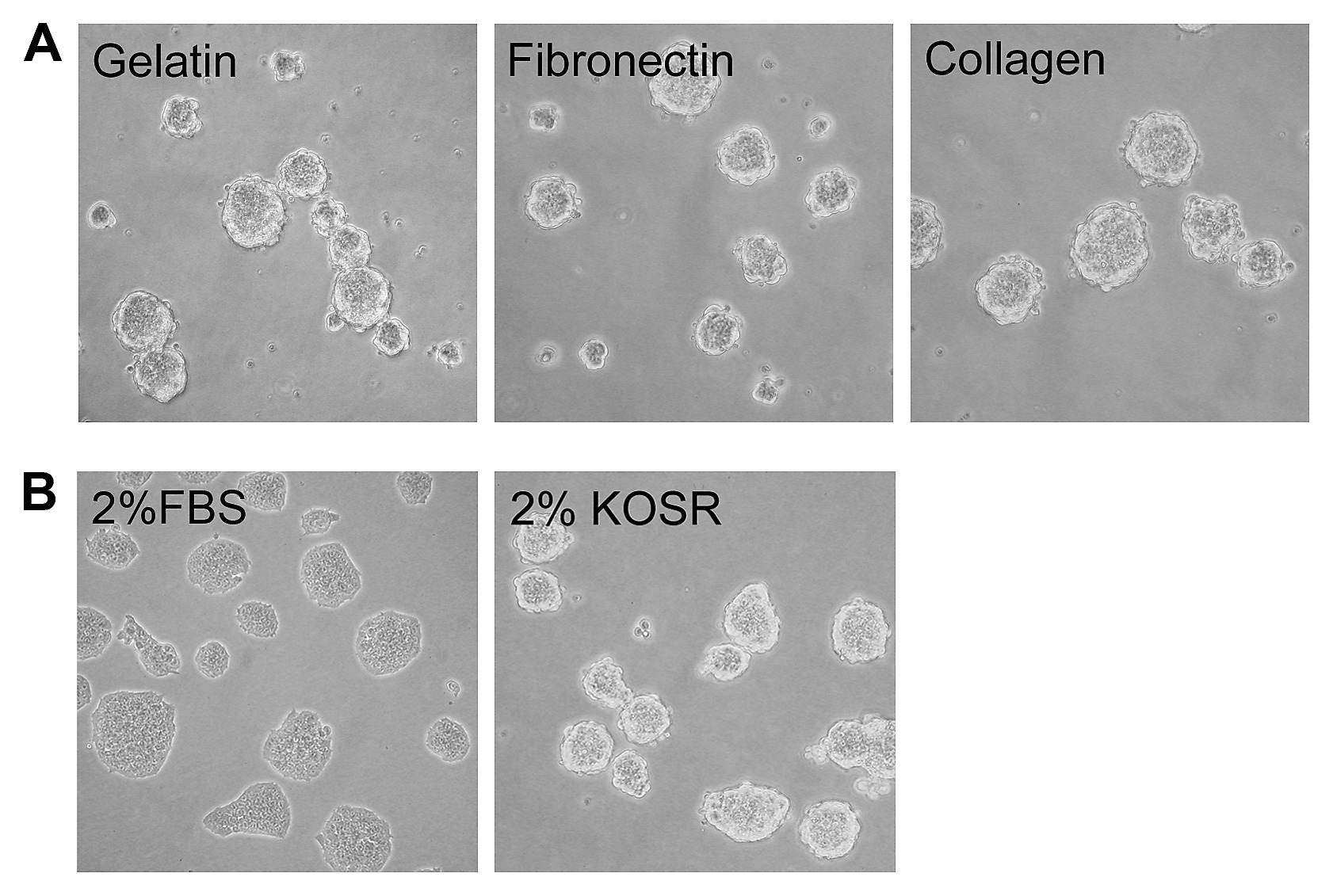 A Comparative Study Of Protocols For Mouse Embryonic Stem Cell