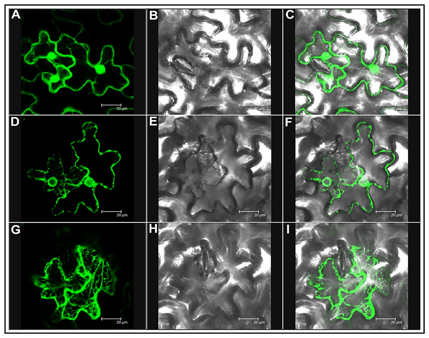 tobacco transient expression in Nicotiana benthamiana leaves. A, Transient expression of maize ZmGAD1