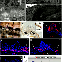 Item - Basal tubercle cells display increased proliferation rates ...