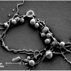 Scanning electron micrograph of P. gingivalis and T. denticola grown in ...