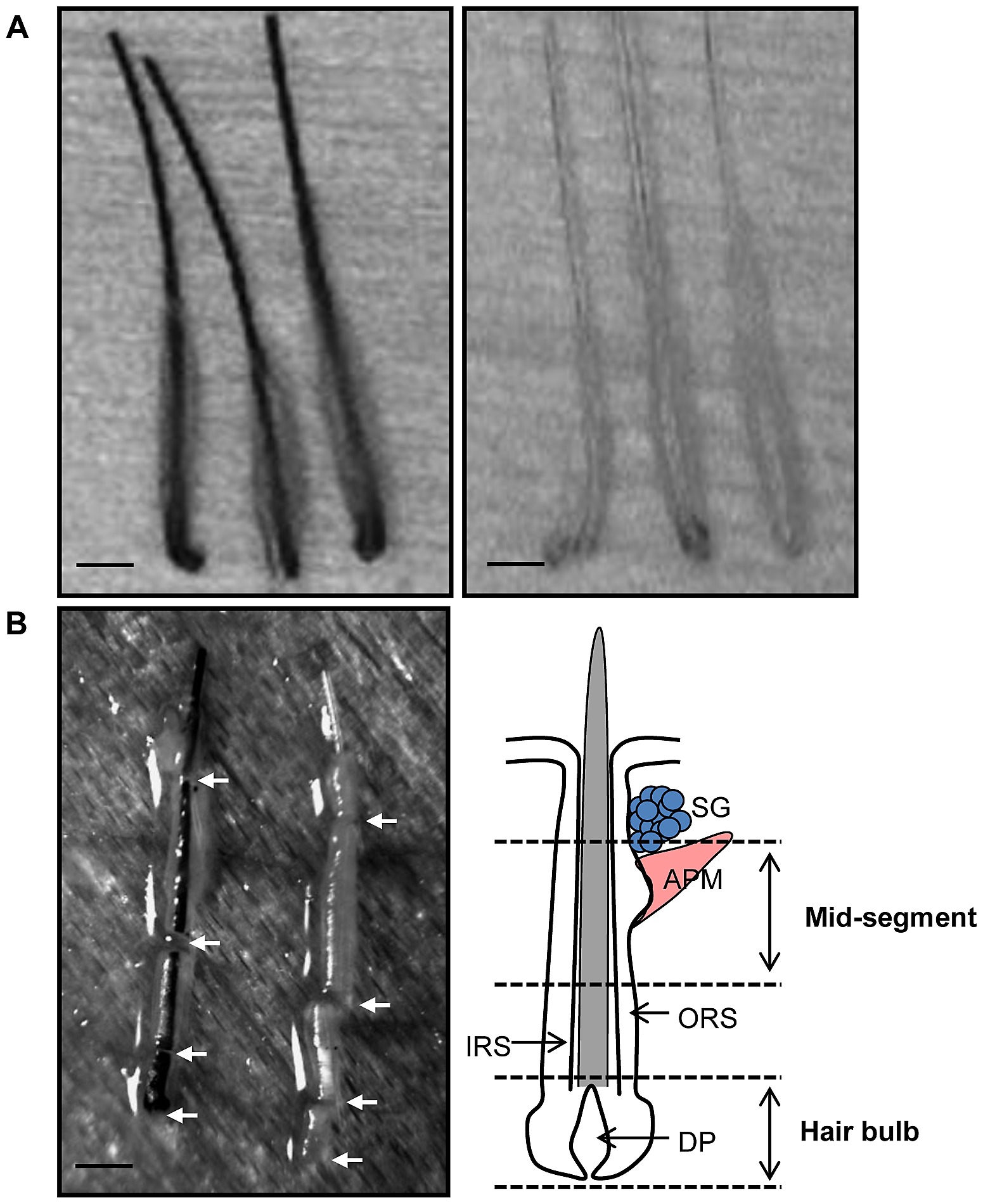 Hair Bulbs And Mid Segments Of Hair Follicles Were Micro Dissected