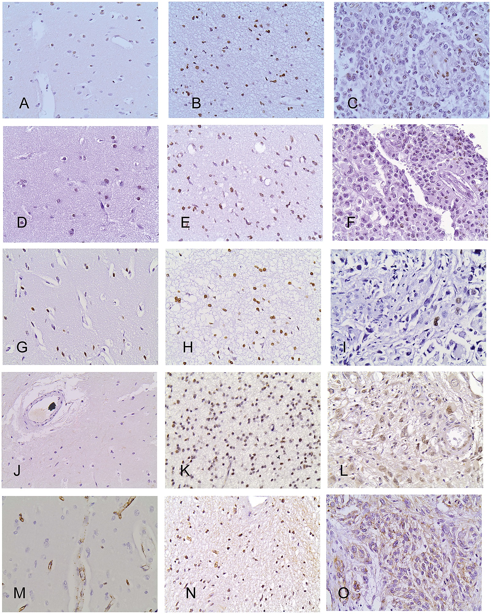 Immunohistochemical Expression Of H1x A B C H4kme3 D E F H3k9me3 G H I Setdb1 J K L And Suv39h1 M N O In Normal Brain Tissue A D G J