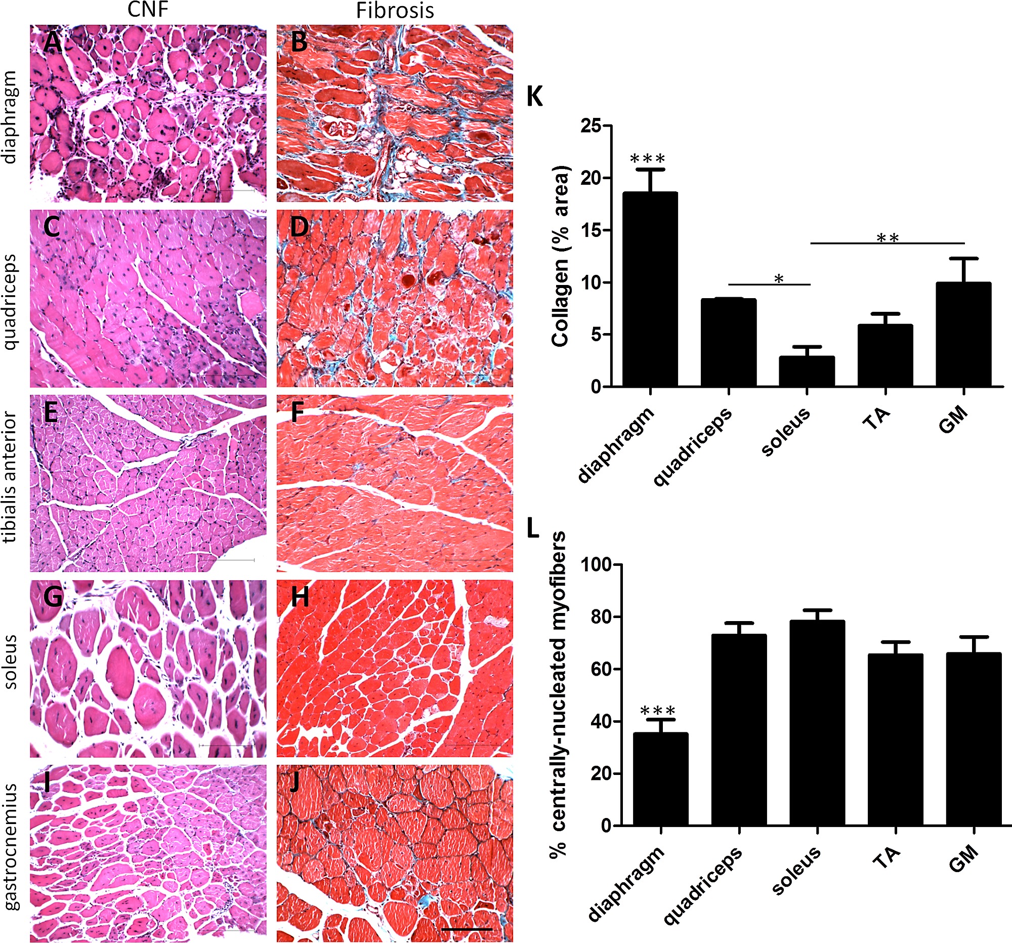 Skeletal muscle BMAL1 is necessary for transcriptional adaptation of local  and peripheral tissues in response to endurance exercise training | bioRxiv, image size:2000x1863