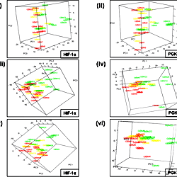 3D PCA plots showing clustering of GBM tumors belonging to HIF-1α ...