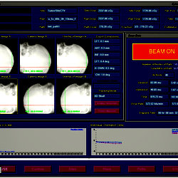 Image registration process.