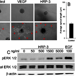 HRP-3 induces endothelial cell sprouting and ERK activation.