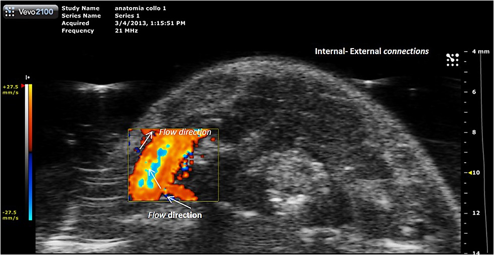 ÎÏÎ¿ÏÎ­Î»ÎµÏÎ¼Î± ÎµÎ¹ÎºÏÎ½Î±Ï Î³Î¹Î± Ecocolor doppler