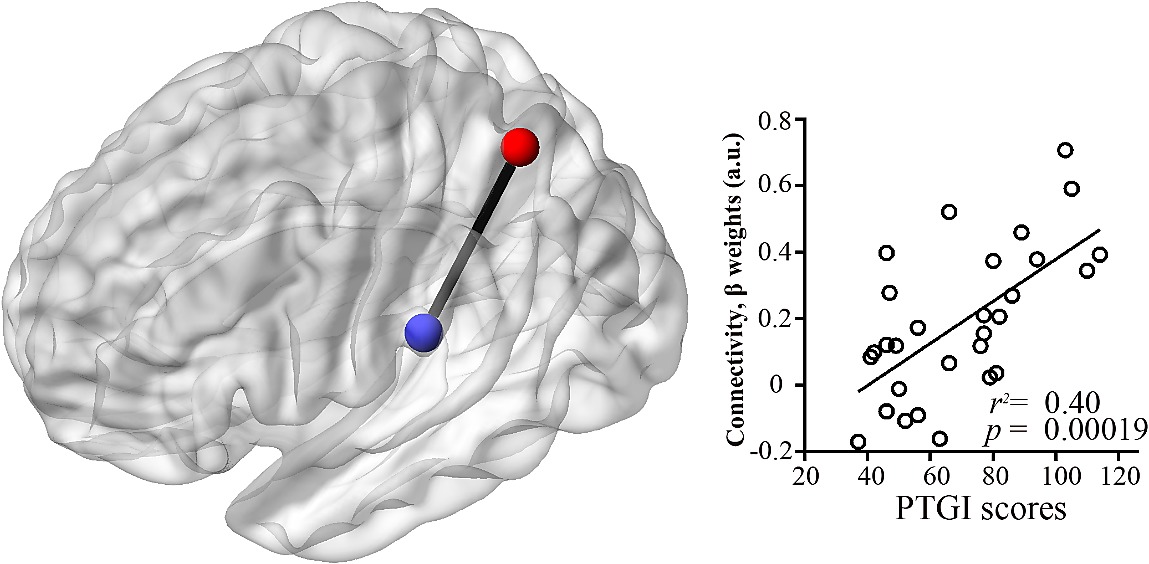 Brain Regions Showing Positive Correlations Between The Scores On The Ptgi And The Strength Of The Functional Connectivity From The Superior Parietal Lobule Seed
