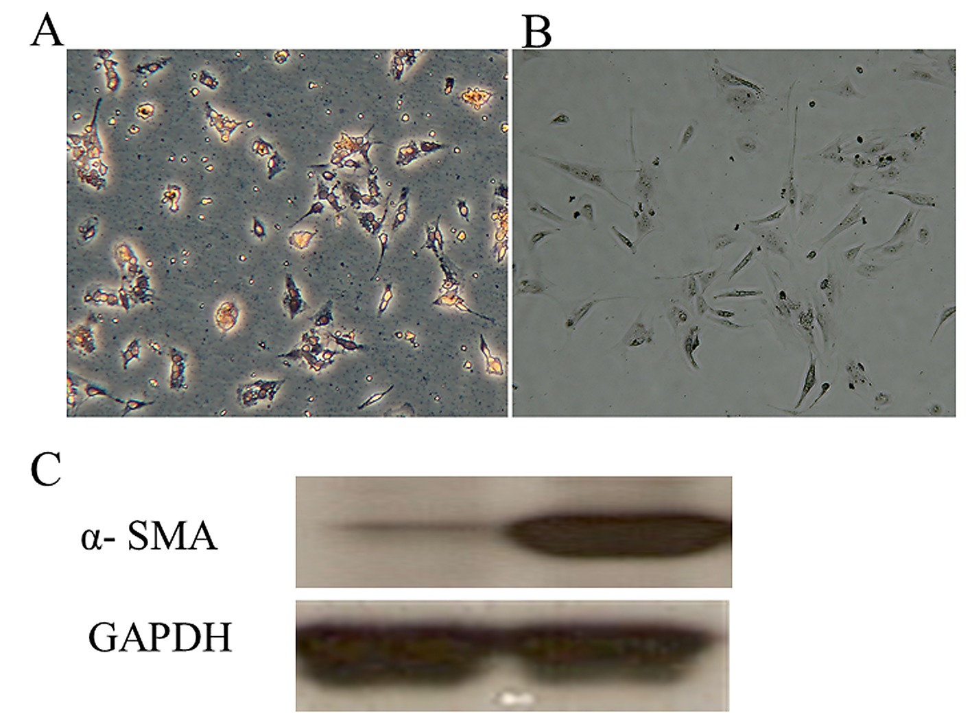 Oil Red O Staining And A Smooth Muscle Actin A Sma In The Hepatic Stellate Cell Hsc