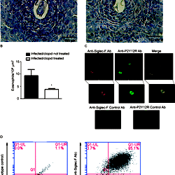 P2Y12R blockade impairs hepatic granulomatous eosinophilia.