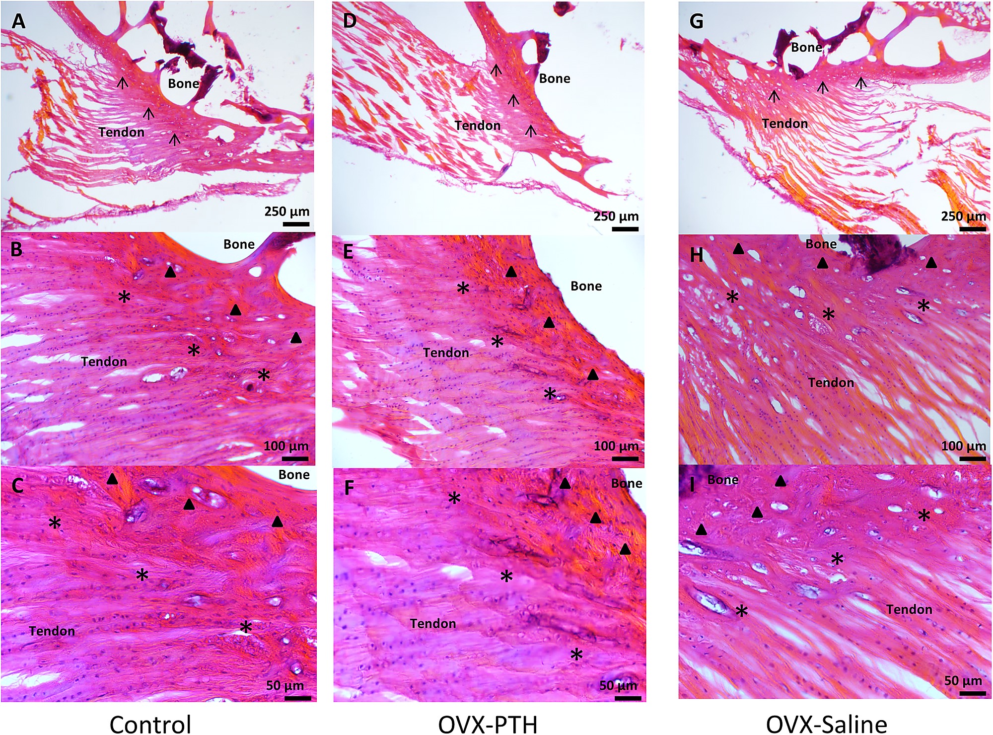 Enthesis of tendon