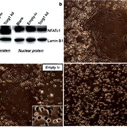 Nuclear translocation of NFATc1 is decreased in Tcirg1-knockdown ...