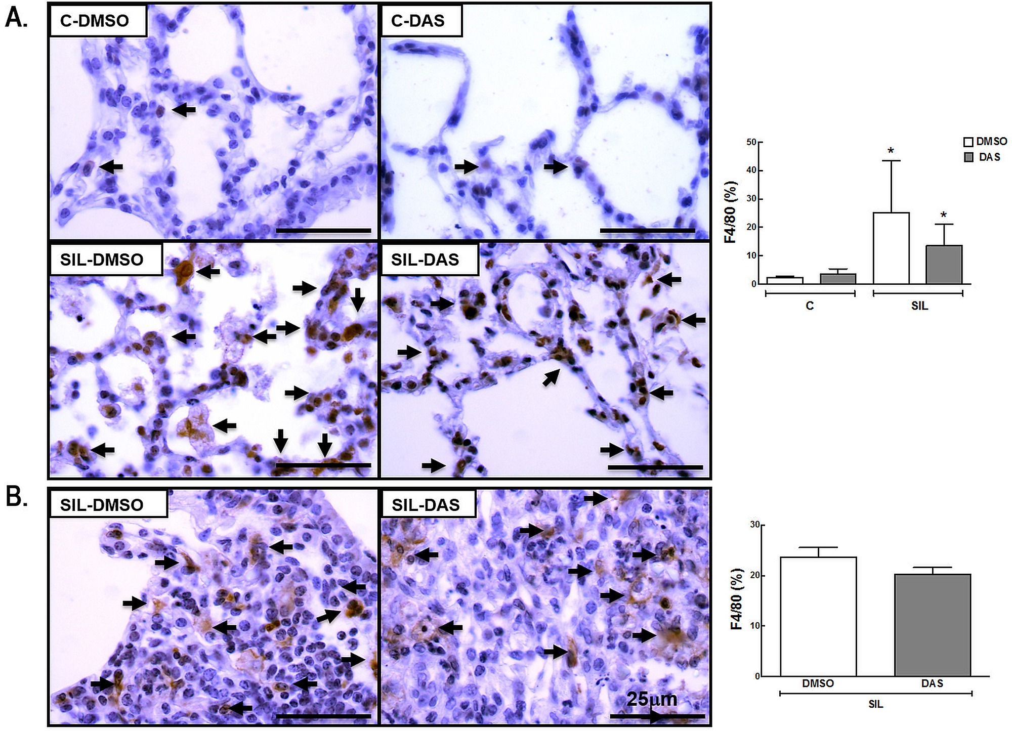 Representative Immunohistochemistry Photomicrographs And Quantification Of Total Macrophages F4 80 Positive Cells
