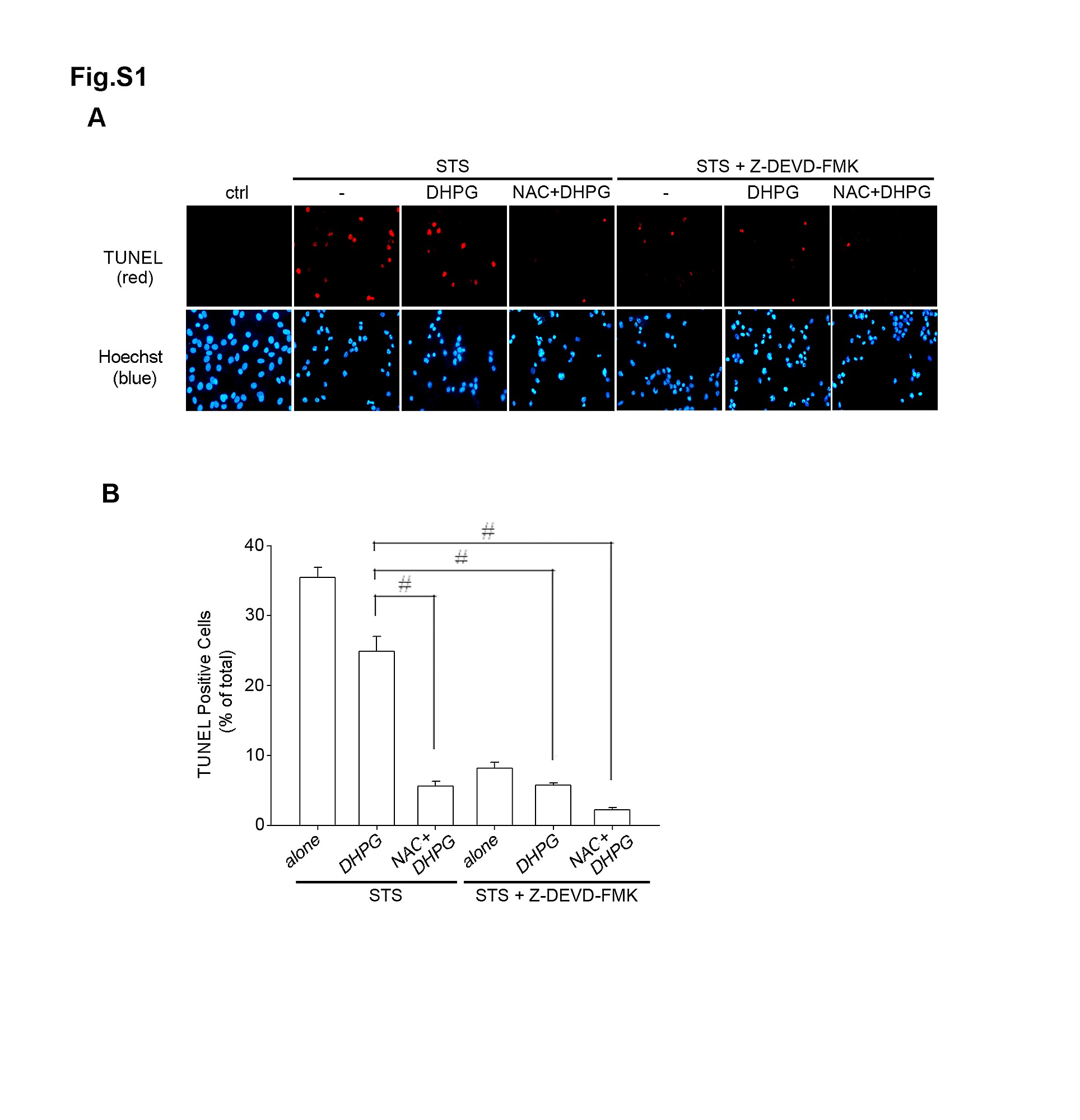N-acetylcysteine Protects against ... through Apoptosis Apoptosis Protects through N-acetylcysteine against ...