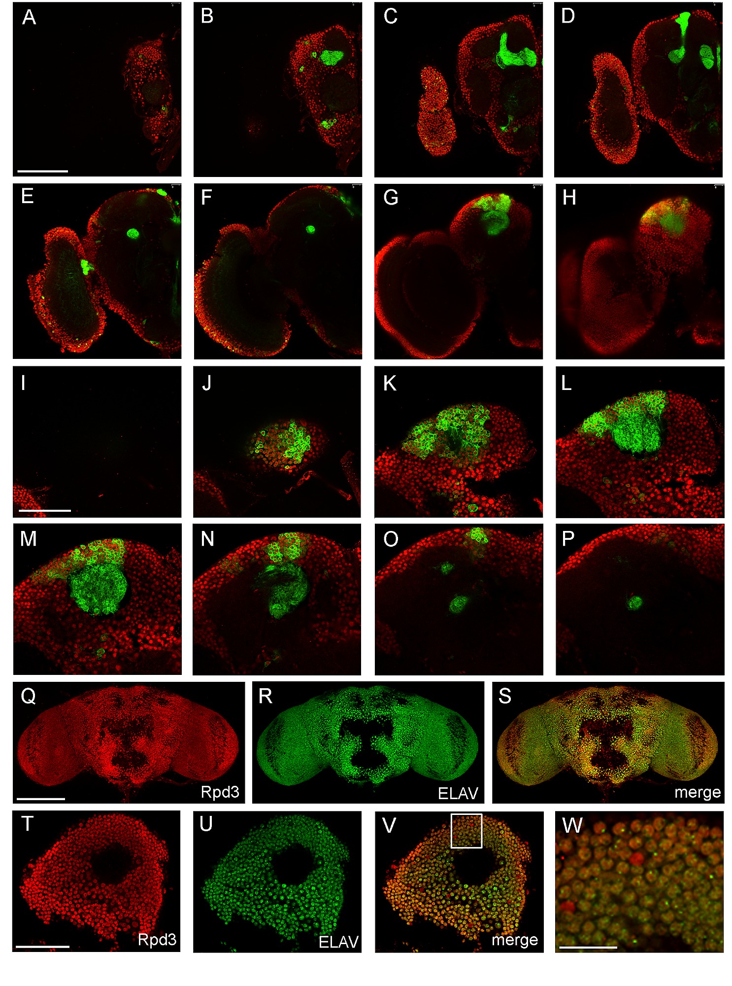 genetic modulation of rpd3 expression impairs long
