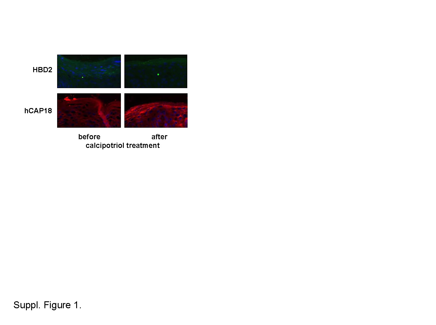 Vitamin D Analogs Differentially Control Antimicrobial