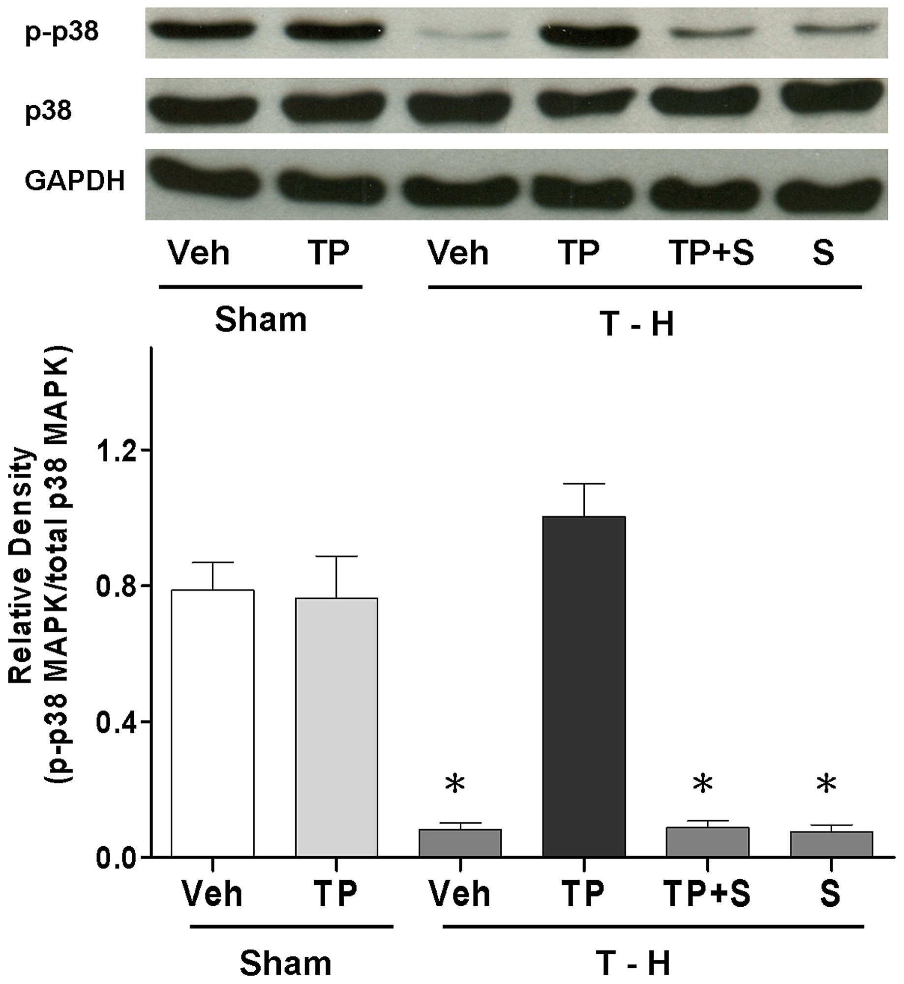 Hepatic P P38 Mapk And P38 Mapk Protein Expression From Sham Animals Receiving Vehicle Sham Veh Lane 1 Or Tropisetron Sham Tp Lane 2 Trauma Hemorrhage Receiving Vehicle T H Veh Lane 3 Tropisetron T H Tp Lane 4 Tropisetron