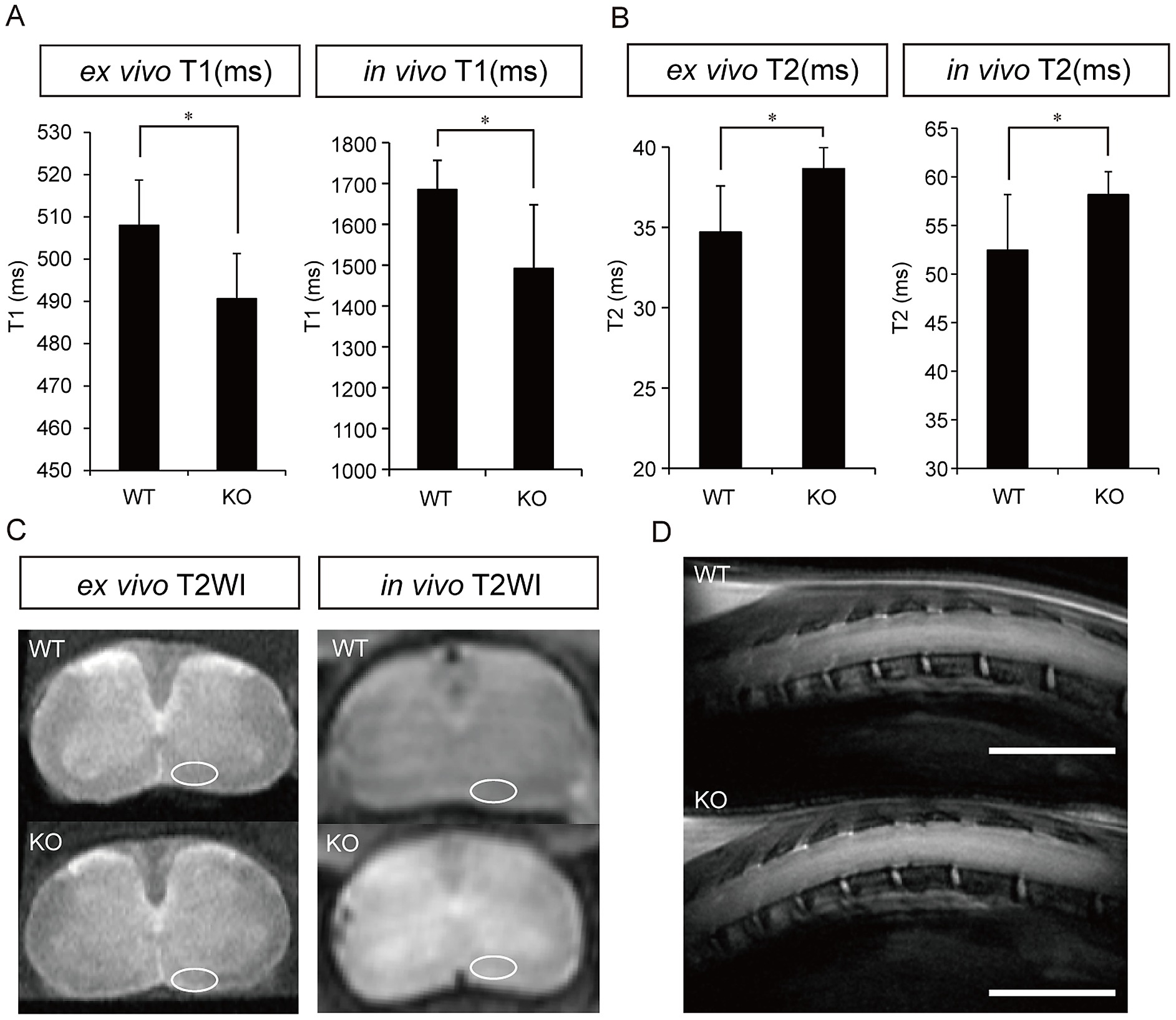 Magnetic Resonance Images Of The Spinal Cords Of Wt And Cst Ko Mice