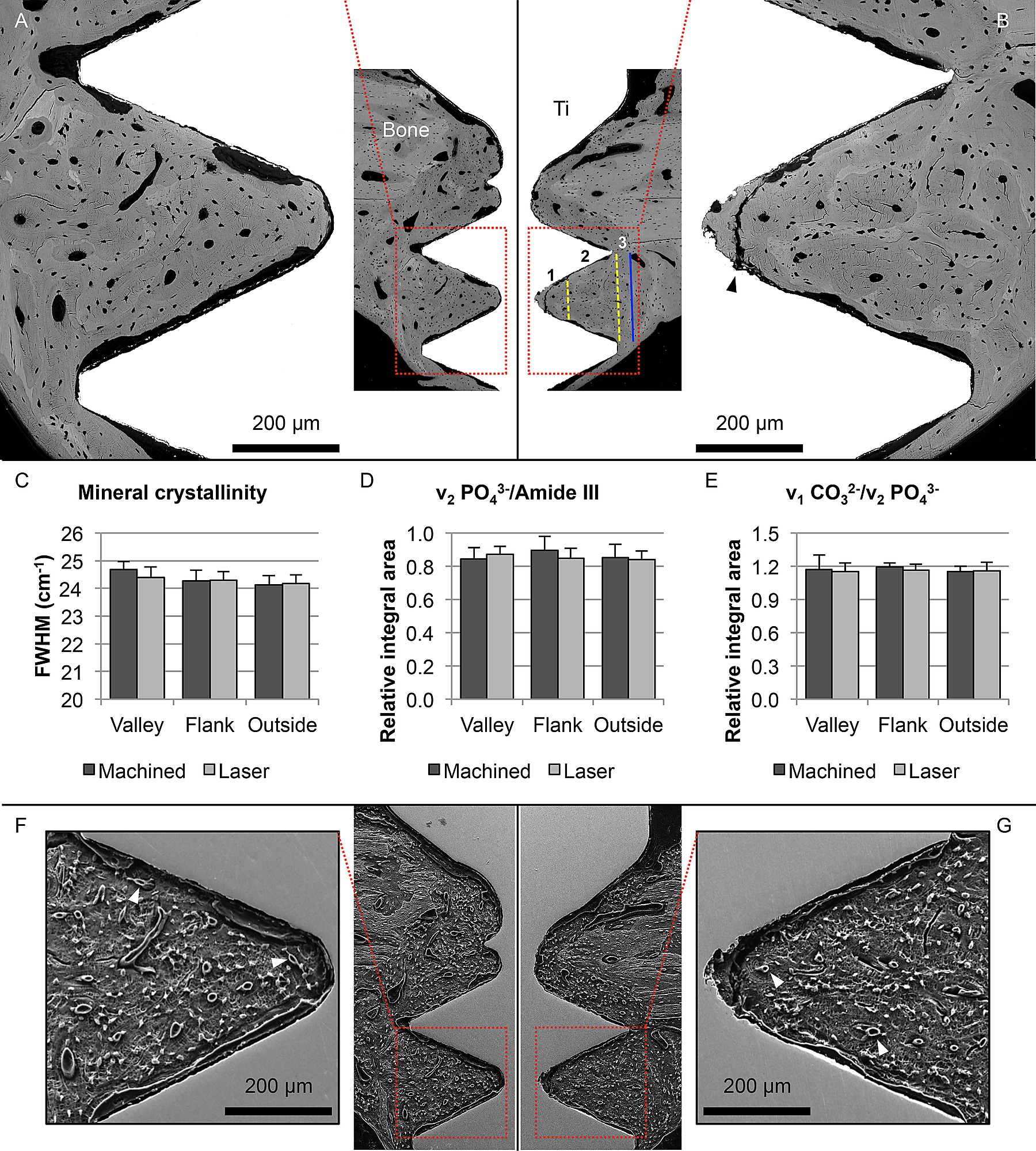 Backscattered Electron Scanning Electron Microscopy Bse Sem Raman Spectroscopy And Resin Cast Etching