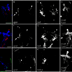 Morphology of the IP Cells.