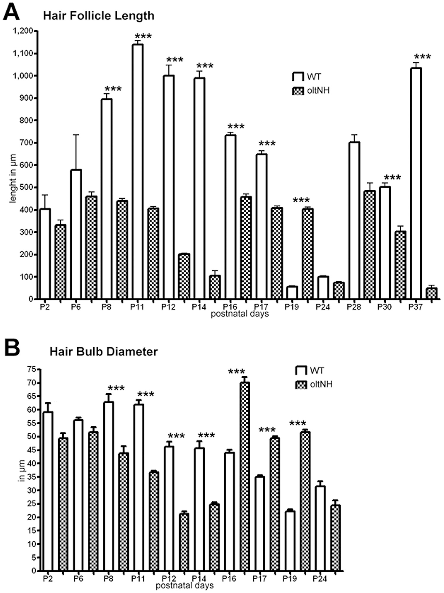 Histomorphometric Analysis Of Hair Follicle Length And Hair Bulb