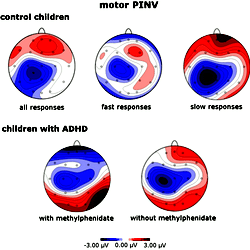 Motor PINV topography for healthy control children.
