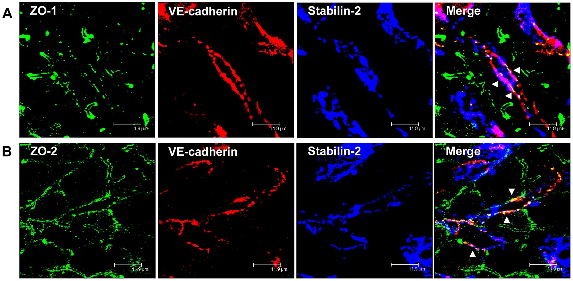 Zo 1 And Zo 2 Localize To Ve Cadherin Containing Cell Cell Junctions In Rat Liver Sinusoidal Endothelial Cells