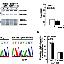 ALKWT and ALKF1174L expression and phosphorylation in the SH-SY5Y