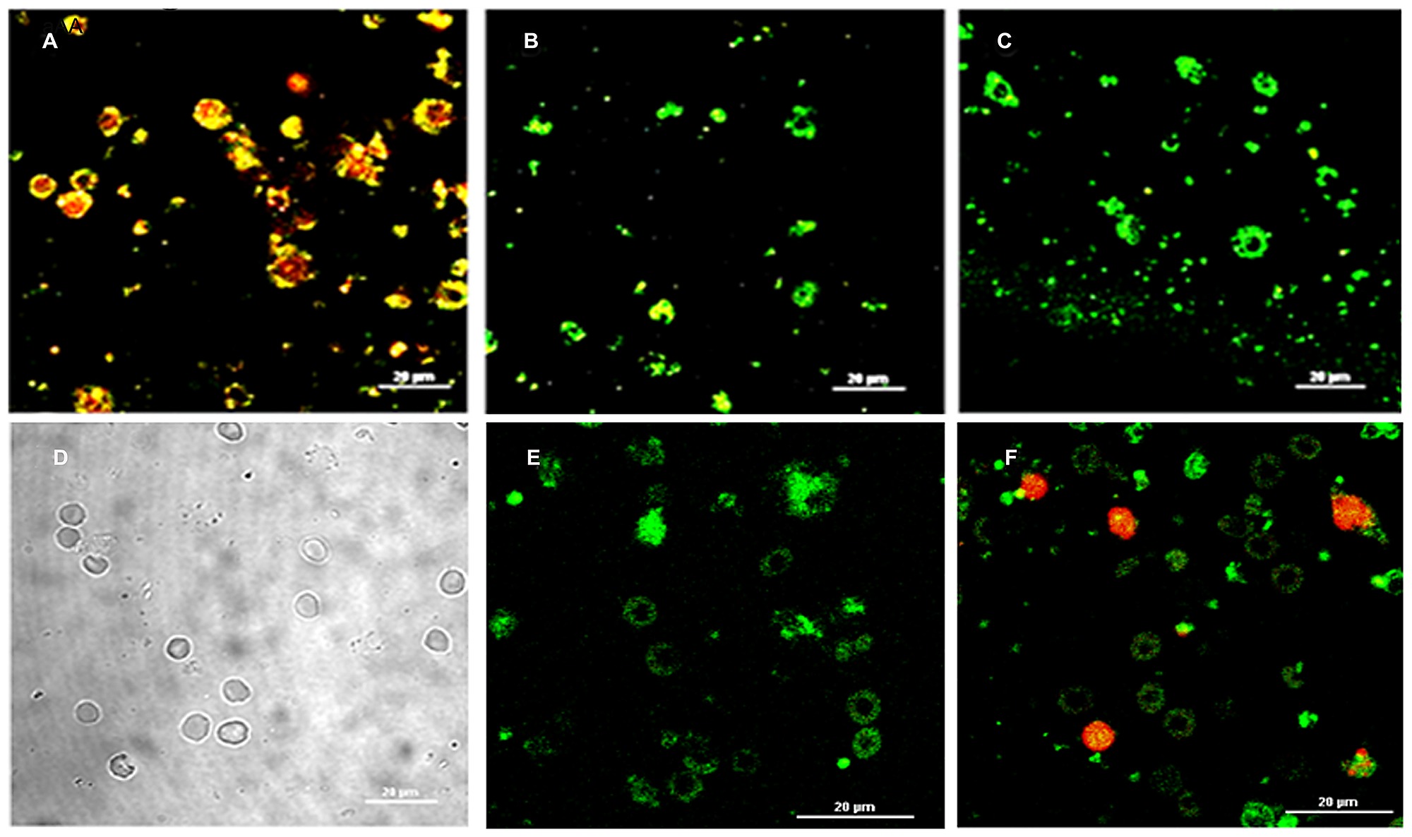 annexin v pi staining