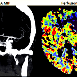 Reviewing example of a patient that presented to the ER with right ...