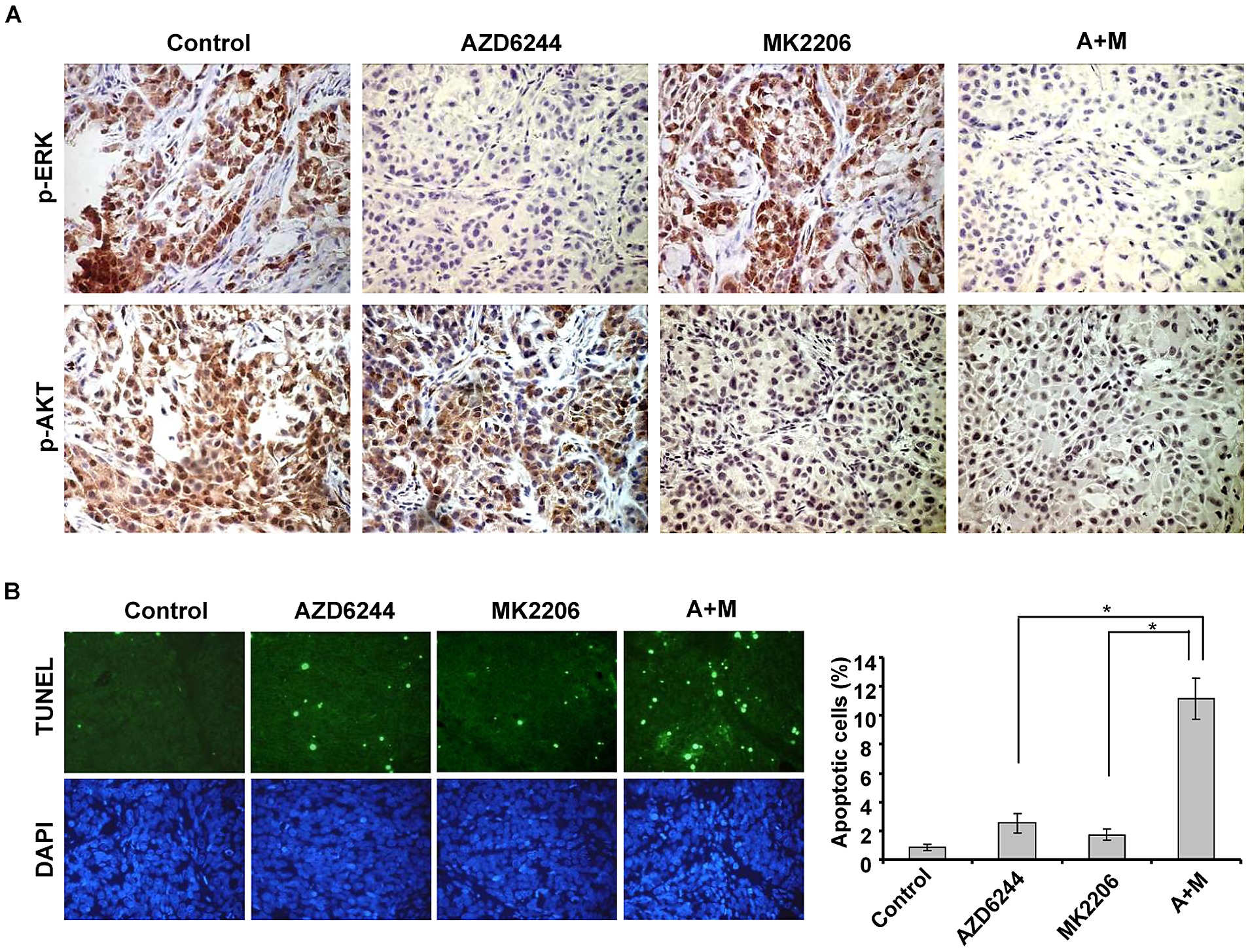 Item - Pharmacodynamic effects of AZD6244-MK2206 on A549 xenograft