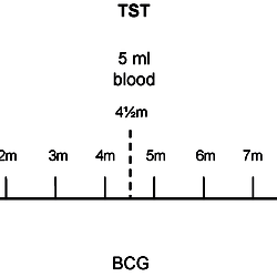 BCG vaccine schedule of study subjects.