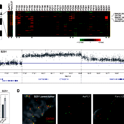 GATA6 is focally amplified in pancreatobiliary cancer.