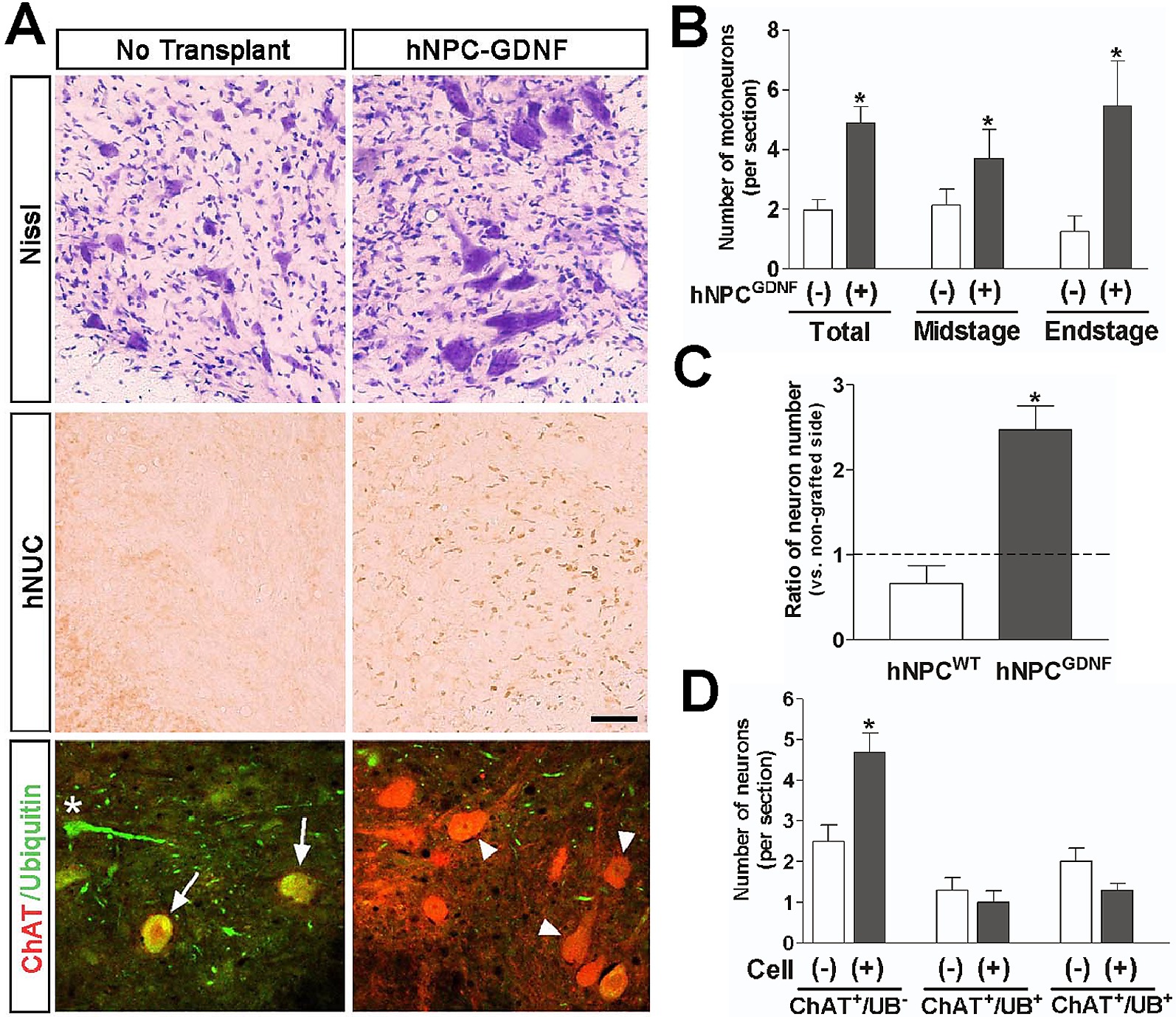 Gdnf Released From The Hnpc Is Critical For Motor Neuron Survival In This Model Gdnf Released From The Hnpc Is Critical For Motor Neuron Survival In This Model