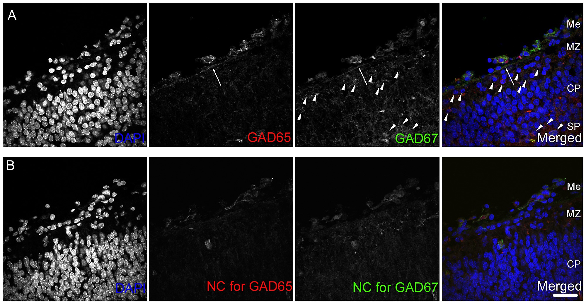 Item - GAD65 and GAD 67 expression in the E14.5 neocortical