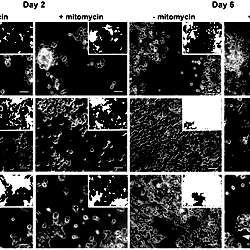 Phase contrast images of live-cells under the monitored conditions for days  and  after treatment.
