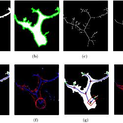 An example of skeletonization result.