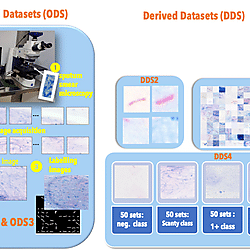 <b>ODS2 - Dataset of smear microscopy images labelled to evaluate algorithms for bacilli detection</b>