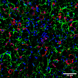 Supporting data for:<b> </b><b>Caspase-8 expression in CD8</b><sup><strong>+ </strong></sup><b>T cells promotes pathogen restriction in the brain during</b><b><i> </i></b><b><i>Toxoplasma gondii</i></b><b> </b><b>infection</b> (Casp8Ripk3 KO Images)
