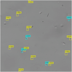 Supplementary Video 1 from Single-Cell 3D tracking by means of Neural Networks for automated sperm classification