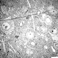 Transmission electron micrographs: lumbar spinal cord