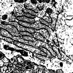 Transmission electron micrographs: globus pallidus