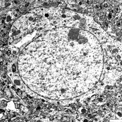 Transmission electron micrographs: striatum
