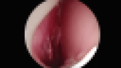 Endoscopic Pituitary Surgery on a High-fidelity Bench-top Phantom
