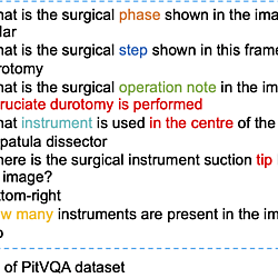 PitVQA: A Dataset of Visual Question Answering in Pituitary Surgery
