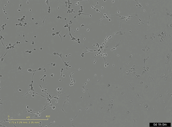 <b>Endothelial cells differentiated from hiPSCs form aligned network structures in engineered neural tissue</b>
